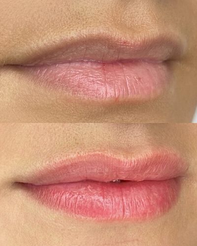 Lippen Permanent Make-up in sanftem, natürlichem Farbton mit weicher Kontur – Beauty Boulevard Frankenthal
